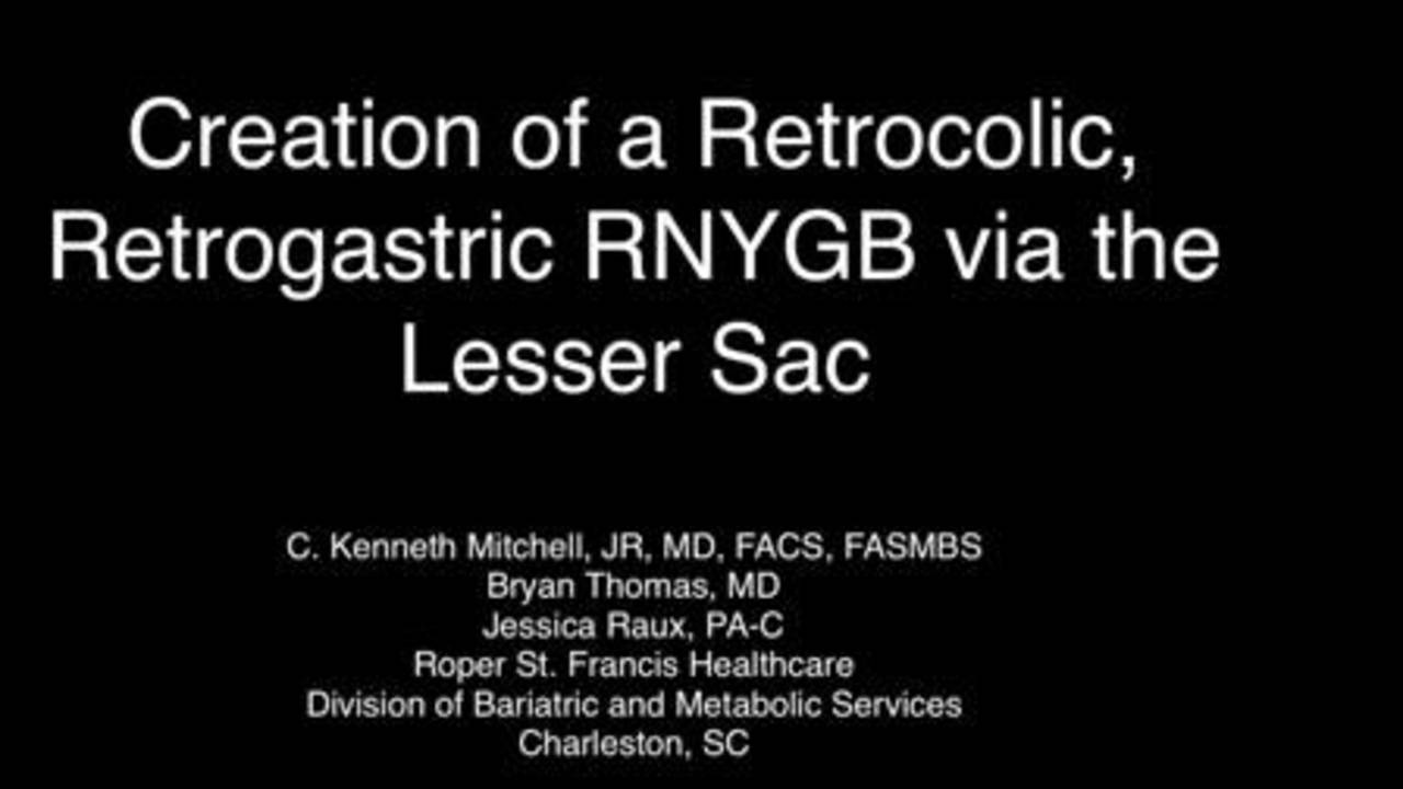 Creation Of A Retrocolic Retrogastric Roux En Y Gastric Bypass Via The Lesser Sac American